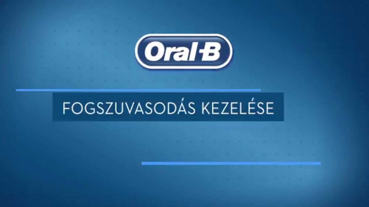 Fogszuvasod&aacute;s kezel&eacute;se