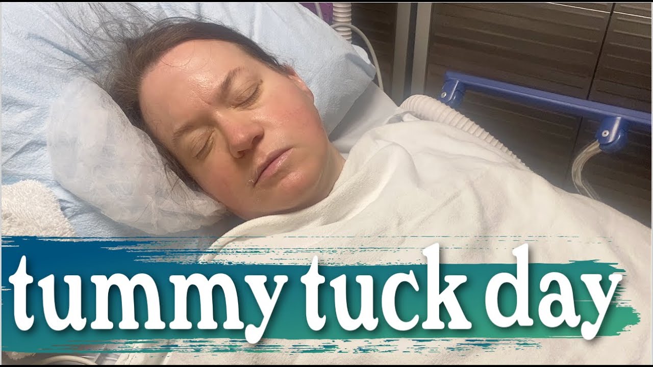 TUMMY TUCK SURGERY DAY | I'M FINALLY GETTING A TUMMY TUCK | ABDOMINOPLASTY SURGERY DAY 2025
