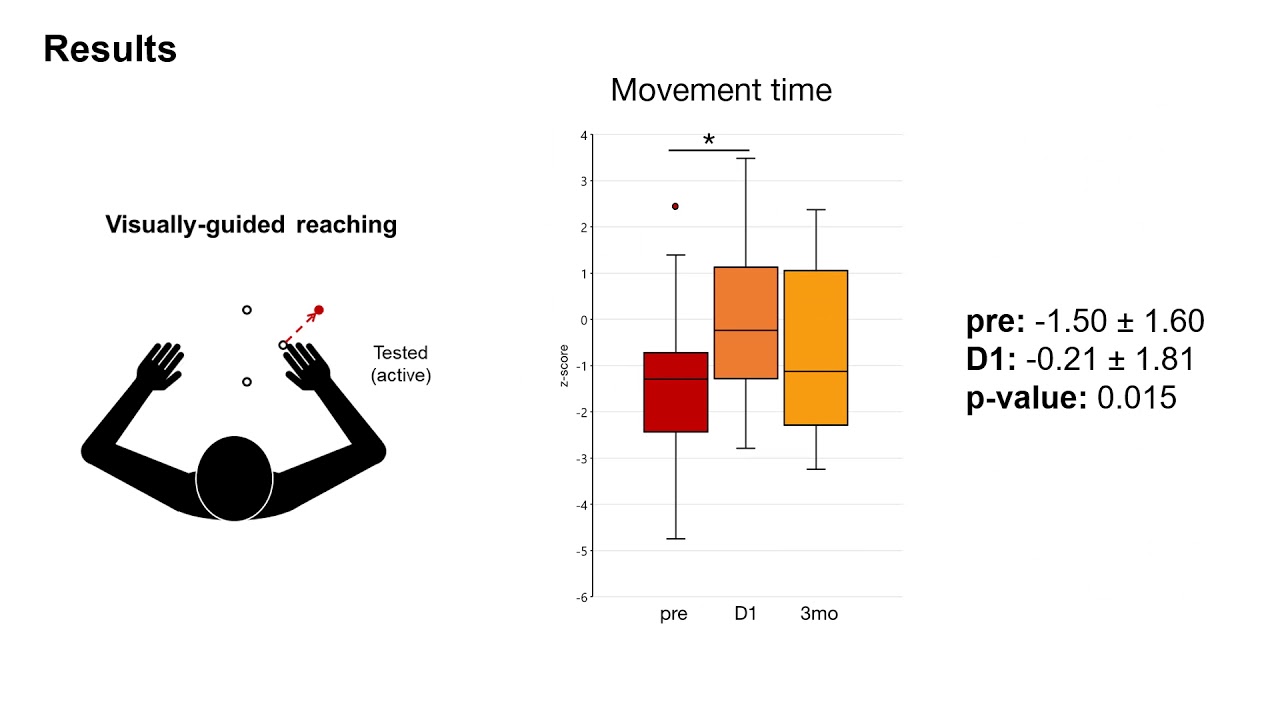 Swytink-Binnema - Reaching and Proprioception After MRgFUS Thalamotomy for Tremor (Poster) (2020)