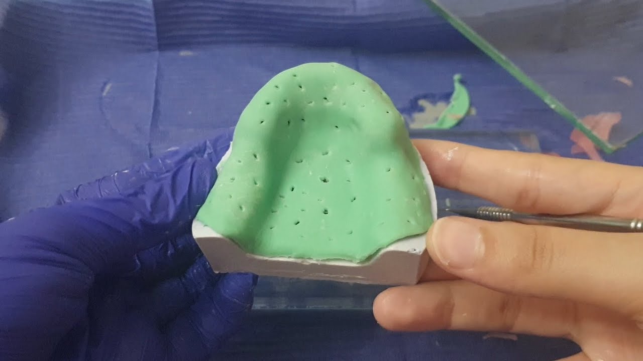 special tray for partial denture with tips💥🦷 and tricks 💥