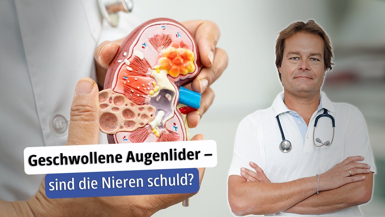 Geschwollene Augenlider - sind die Nieren schuld?