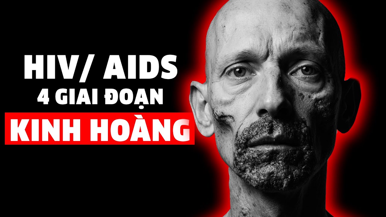 4 giai đoạn KINH HOÀNG của bệnh HIV/ AIDS - Vì sao biết vẫn lao vào?
