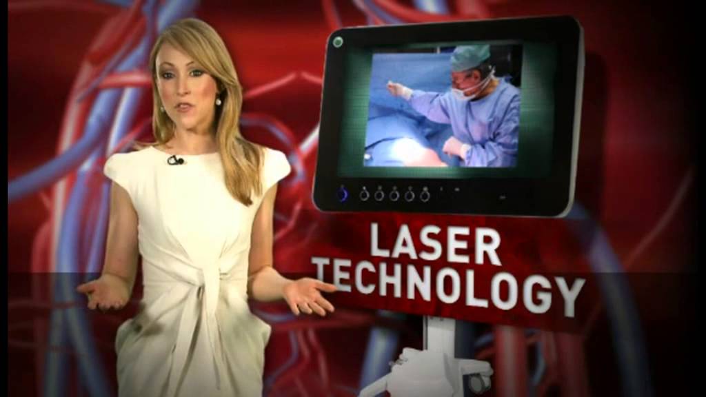 Treatment for Varicose Veins