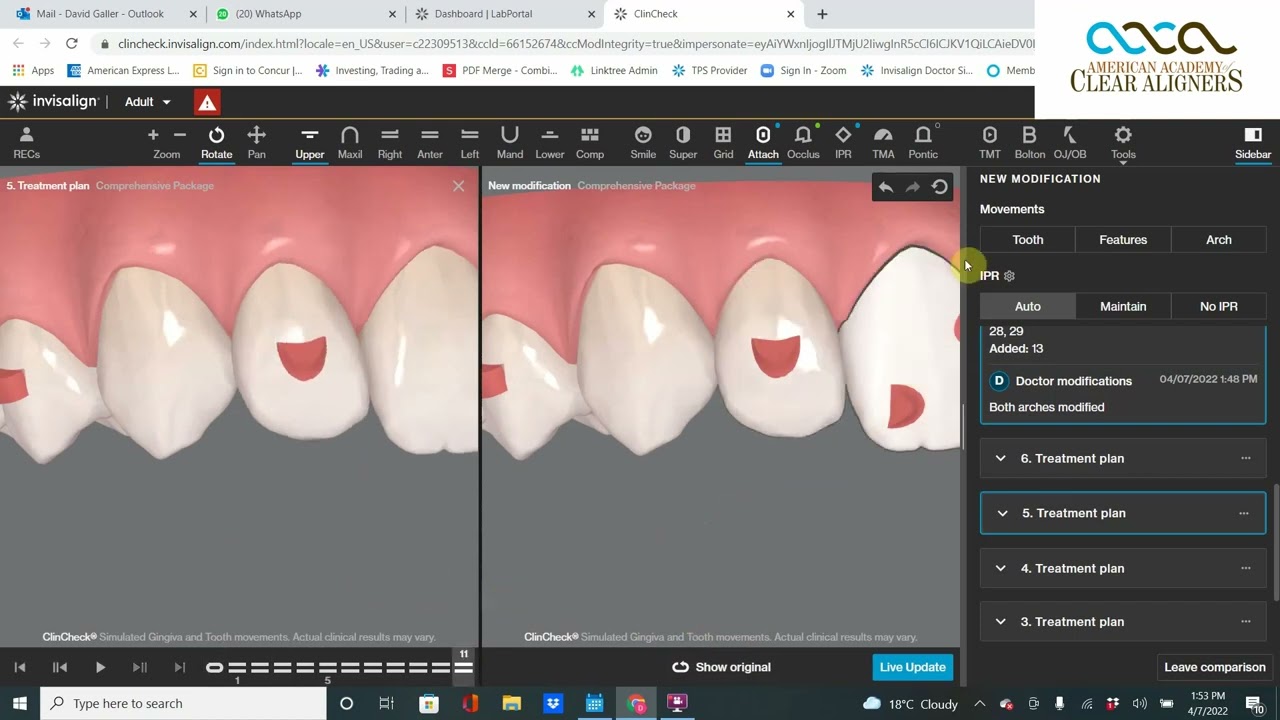The Angulation vs Rotation One