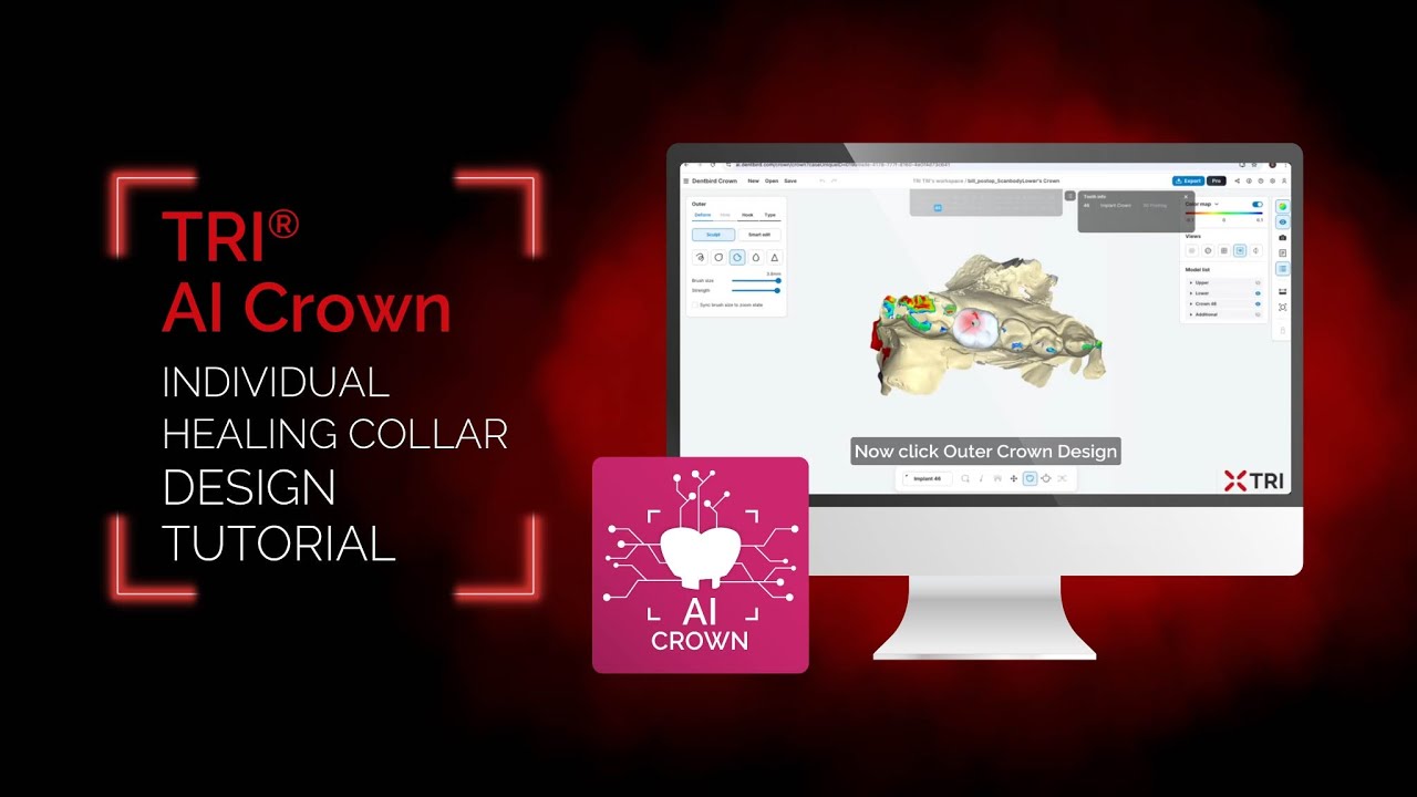 TRI&reg; AI Individual Healing Collar Design Tutorial | matrix&reg; System