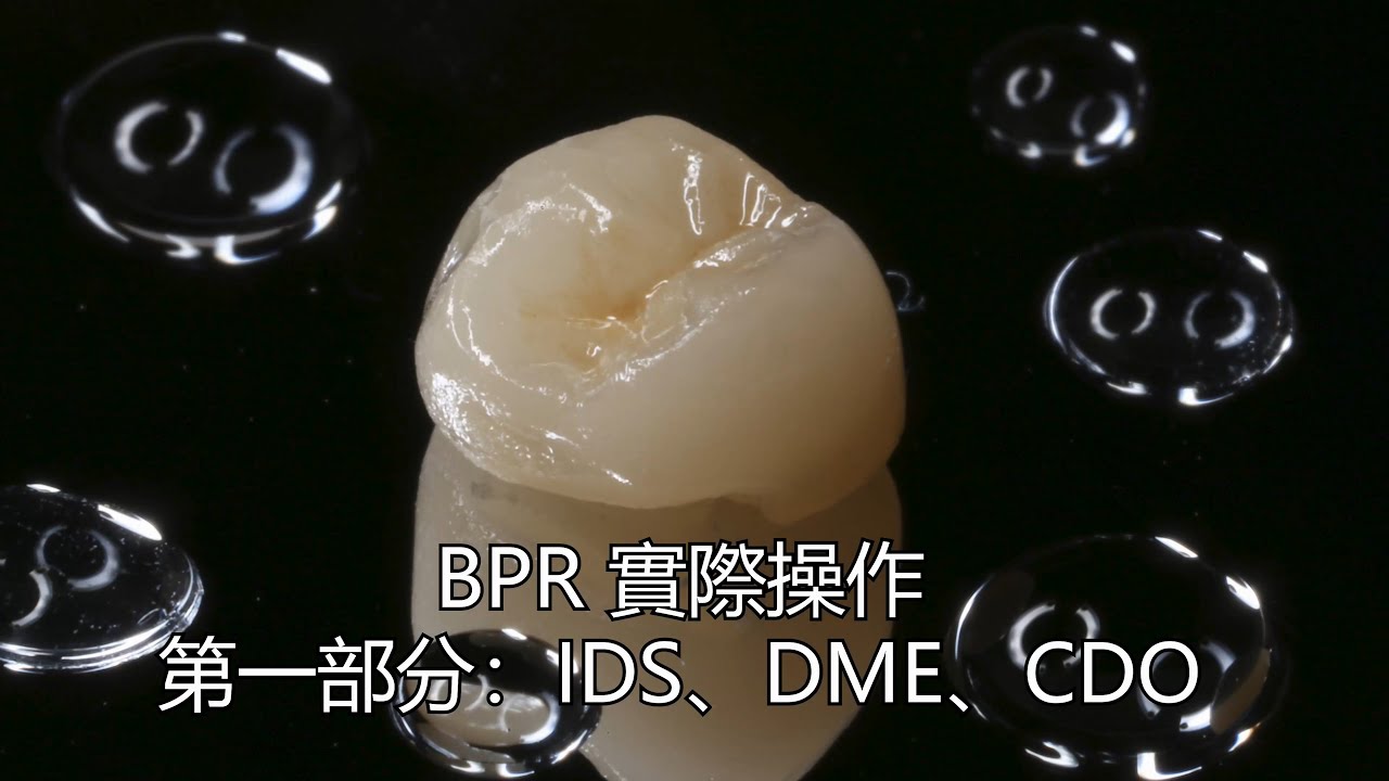 Bonded Porcelain(Partial) Restoration 實際操作part 1： IDS, DME, CDO
