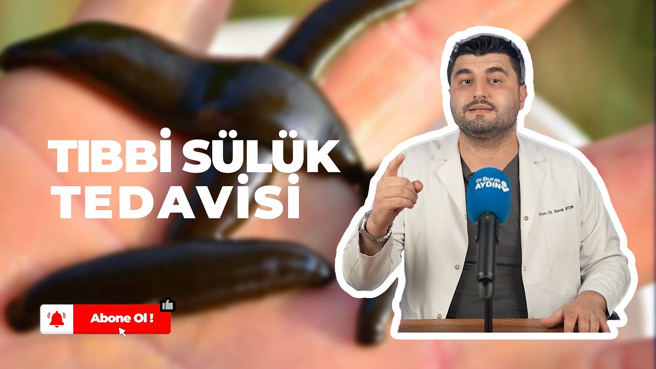 TIBBİ SÜLÜK TEDAVİSİ