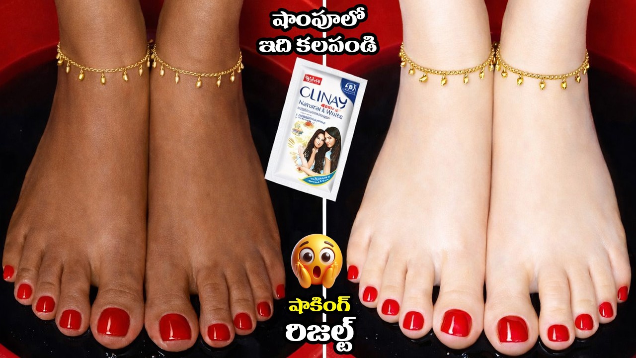 రిజల్ట్ చూసి షాక్ అవుతారు 😱 డార్క్ స్కిన్ అయినా నిమిషాల్లో గ్లోయింగ్ స్కిన్ ✨ 100% నేచురల్ రెమెడీ👌👌👌
