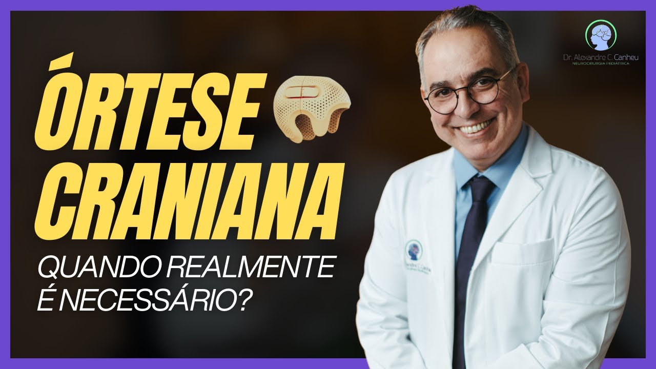 Seu bebê precisa de Órtese Craniana? Entenda as indicações