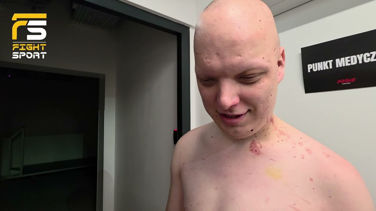 WAMPIESZ PO EPICKIM BOJU Z MURANEM