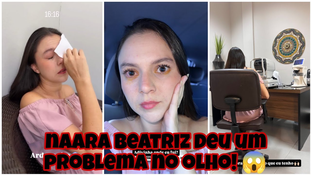 Naara Beatriz teve um problema no olho 😱
