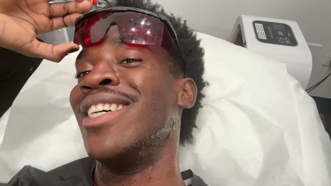 Laser hair removal black man
