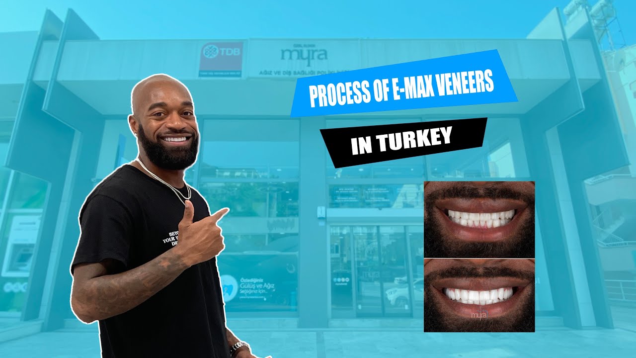 New Teeth with Emax Veneers in Turkey | Myra Dental Centre Turkey 🦷