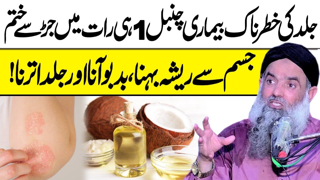 جلد کی خطرناک بیماری چمبل کا علاج Chambal Ka ilaj || Tadri Ka ilaj || Dr Sharafat Ali