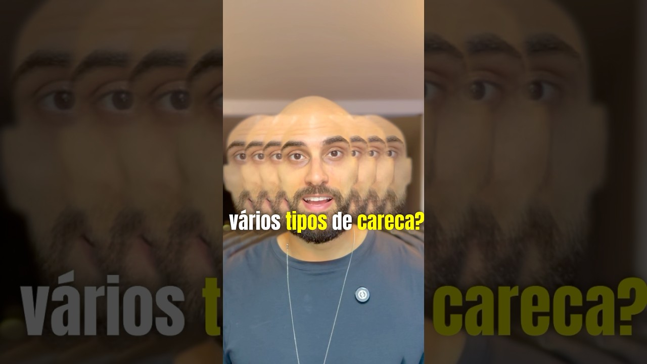 Não existe um tipo certo de careca…Se tiver autoconfiança, vira estilo. 