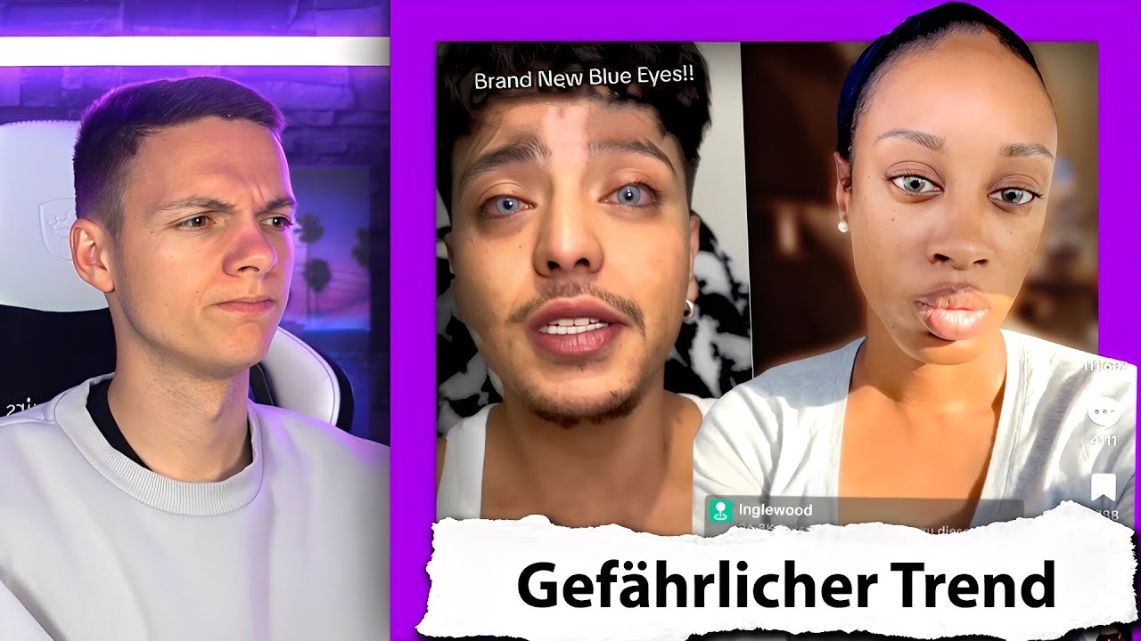 Influencer lassen sich ihre Augen tätowieren & kassieren Karma