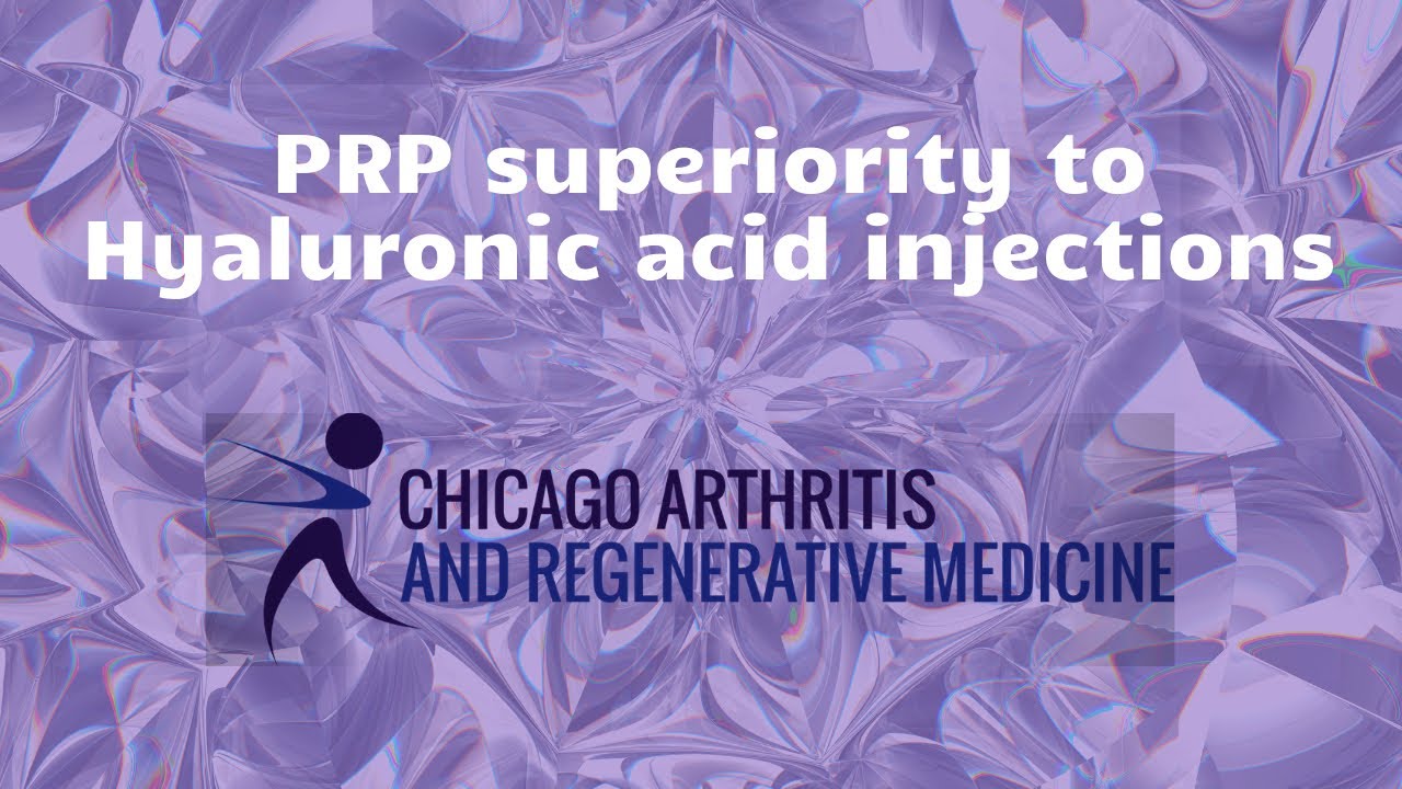 PRP vs Gel injections for Knee Arthritis