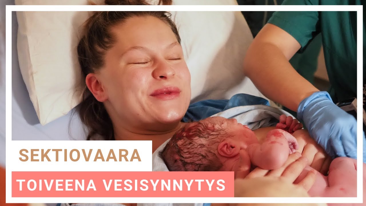 SYNNYTYSTARINA | Aitoa materiaalia synnytyksestä