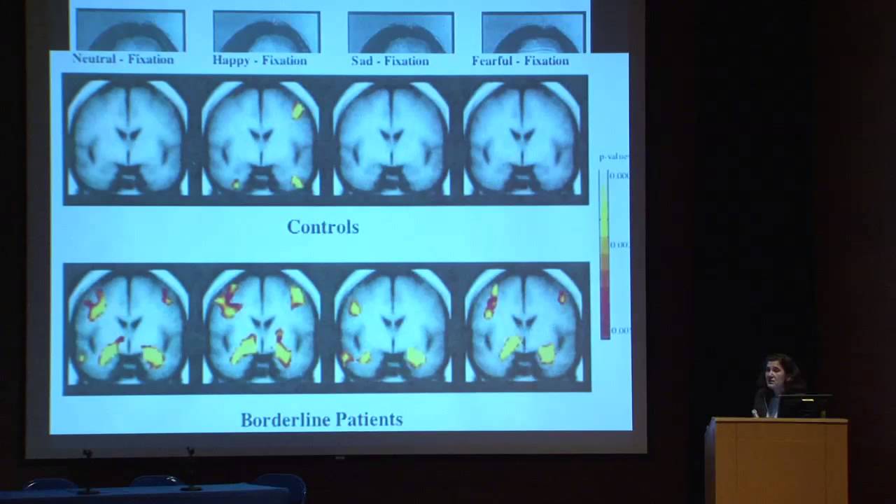 BPD-related cognitive-perceptual difficulties and challenges in their diagnosis and treatment