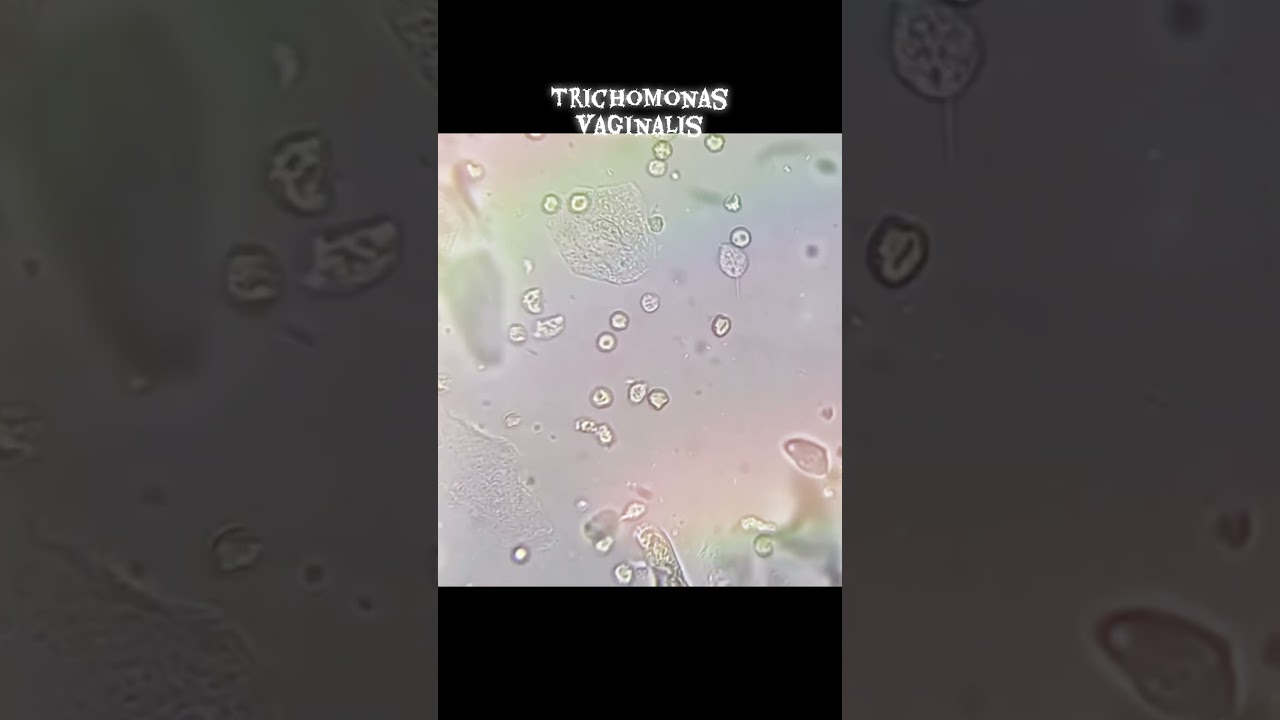 Trophozoite of trichomonas vaginalis 