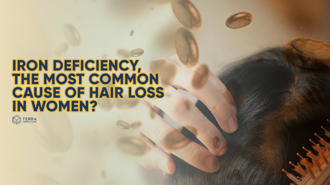 Iron Deficiency, The Most Common Cause of Hair Loss In Women? - Hair Talks by Terra Medical