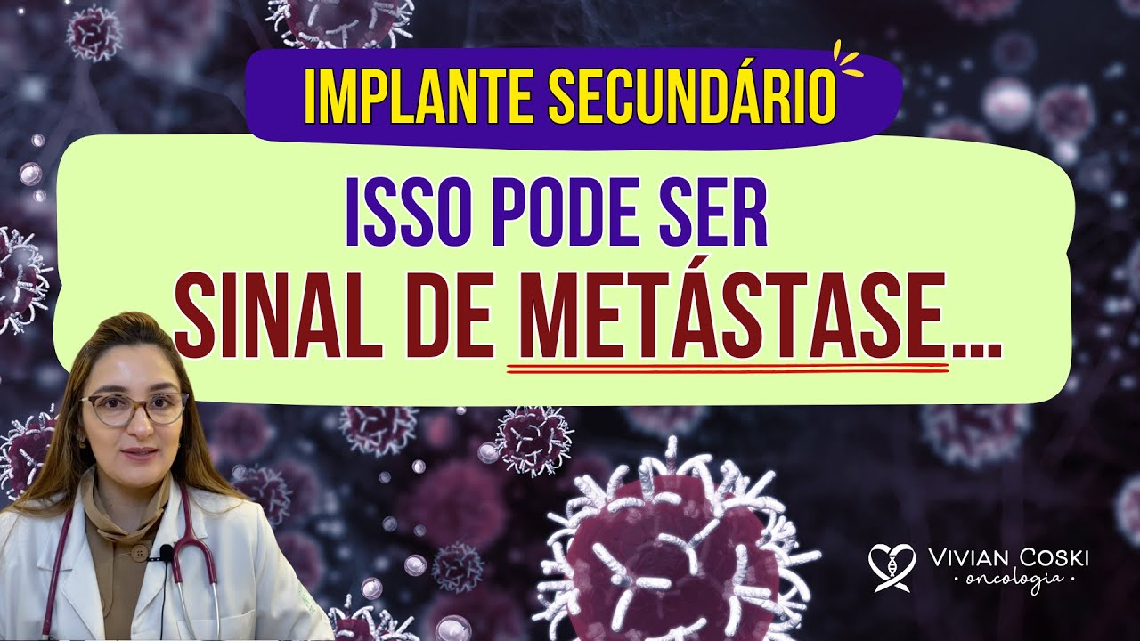 Implante secundário: isso pode ser sinal de metástase do câncer…