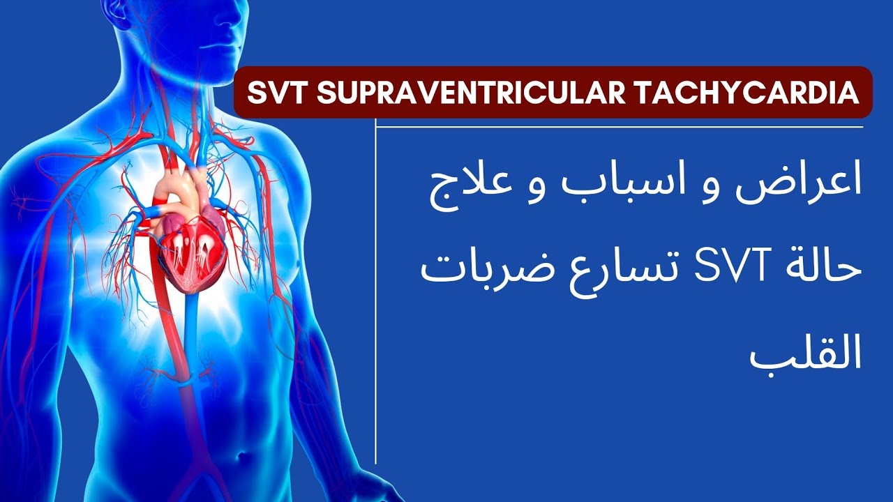شرح حالة SVT تسارع نبضات القلب #طب #Medicine #طب_طوارئ #EmergencyMedicine #تمريض #Nursing #طبيب 