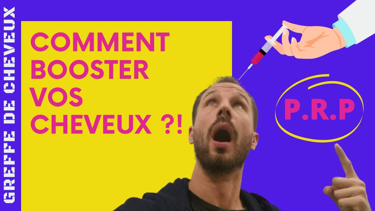 CALVITIE PRP Cheveux - Traitement Plasma Riche en Plaquettes - GREFFE de CHEVEUX en Turquie.