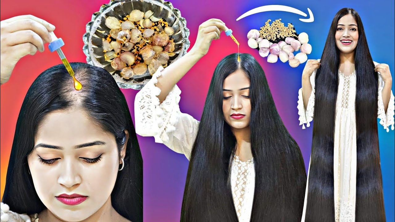 😱I Applied Few Drops Of Most Powerful Diy Oil & Got Massive Hair Growth on Bald Patches Unbelievable