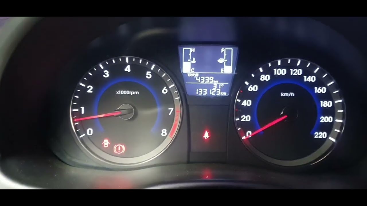 Hyundai accent 2016 . overheating problem. (by jess automotive)