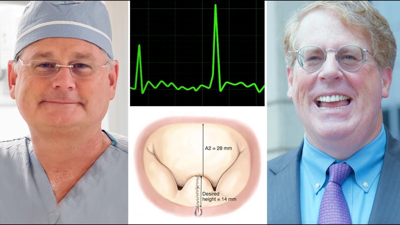 Mitral Valve Repair & AFib Success Story:  Ed Can Walk Upstairs Again!