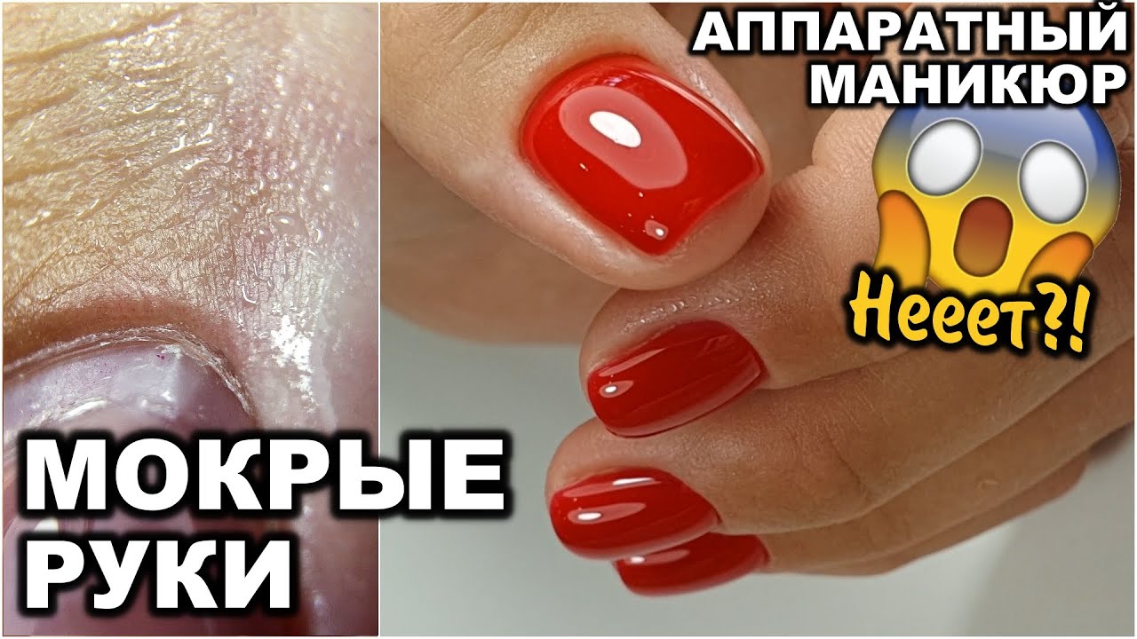 ГИПЕРГИДРОЗ (потеют руки). Аппаратный маникюр на супер влажных руках.