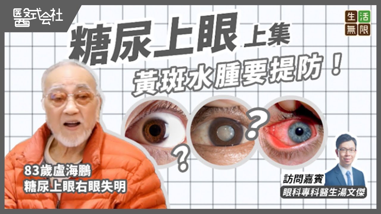 糖尿病引致「糖尿上眼」？(上集)｜盧海鵬糖尿上眼右眼失明｜黃斑水腫治療方法｜#醫式会社(第14集) #視力模糊 #飛蚊症 #青光眼 #白內障 #糖尿上眼食療 #盲 #失明 #podcast