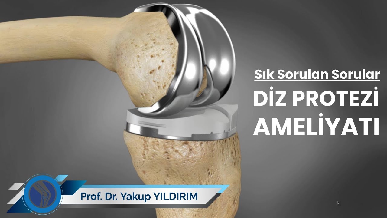 Diz Protezi Ameliyatı - Sık Sorulan Sorular | Prof. Dr. Yakup YILDIRIM