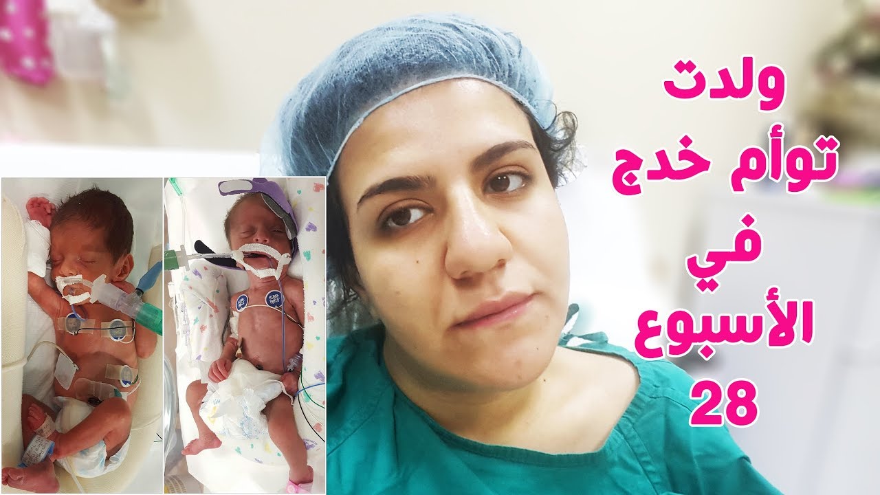 قصة حملي وولادتي توأم خدج في الاسبوع ٢٨ من الحمل (٣ اشهر عناية مركزة)