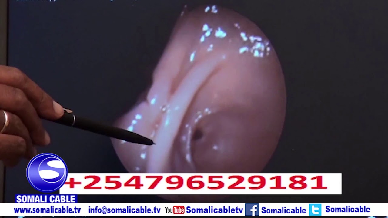 Dr.  Ali Mao - Wax Yaabaha Keena Calool Xanuunka