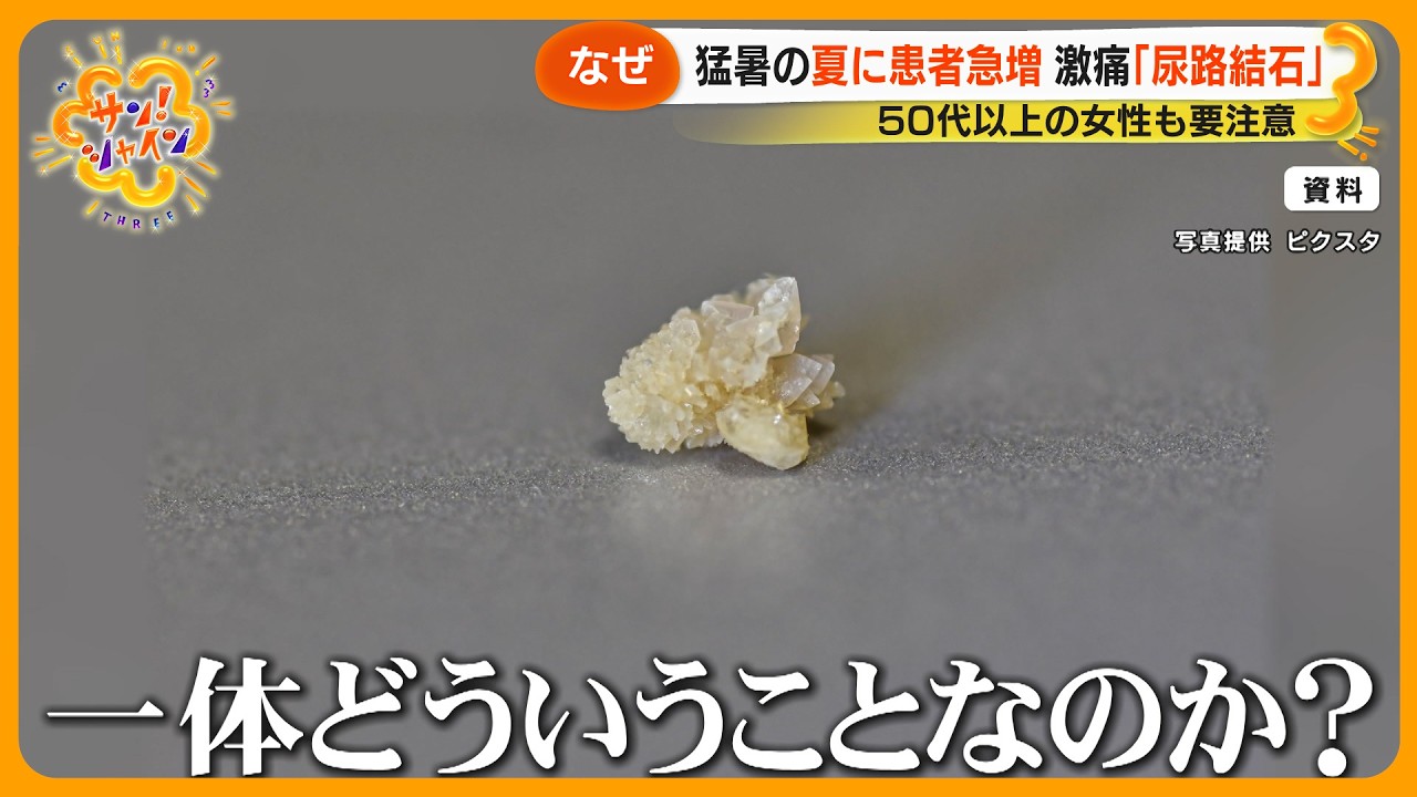 【猛暑】耐えがたい激痛 ｢尿路結石｣ 患者急増 50代以上の女性も要注意！ “理由は脱水”【サン！シャインニュース】