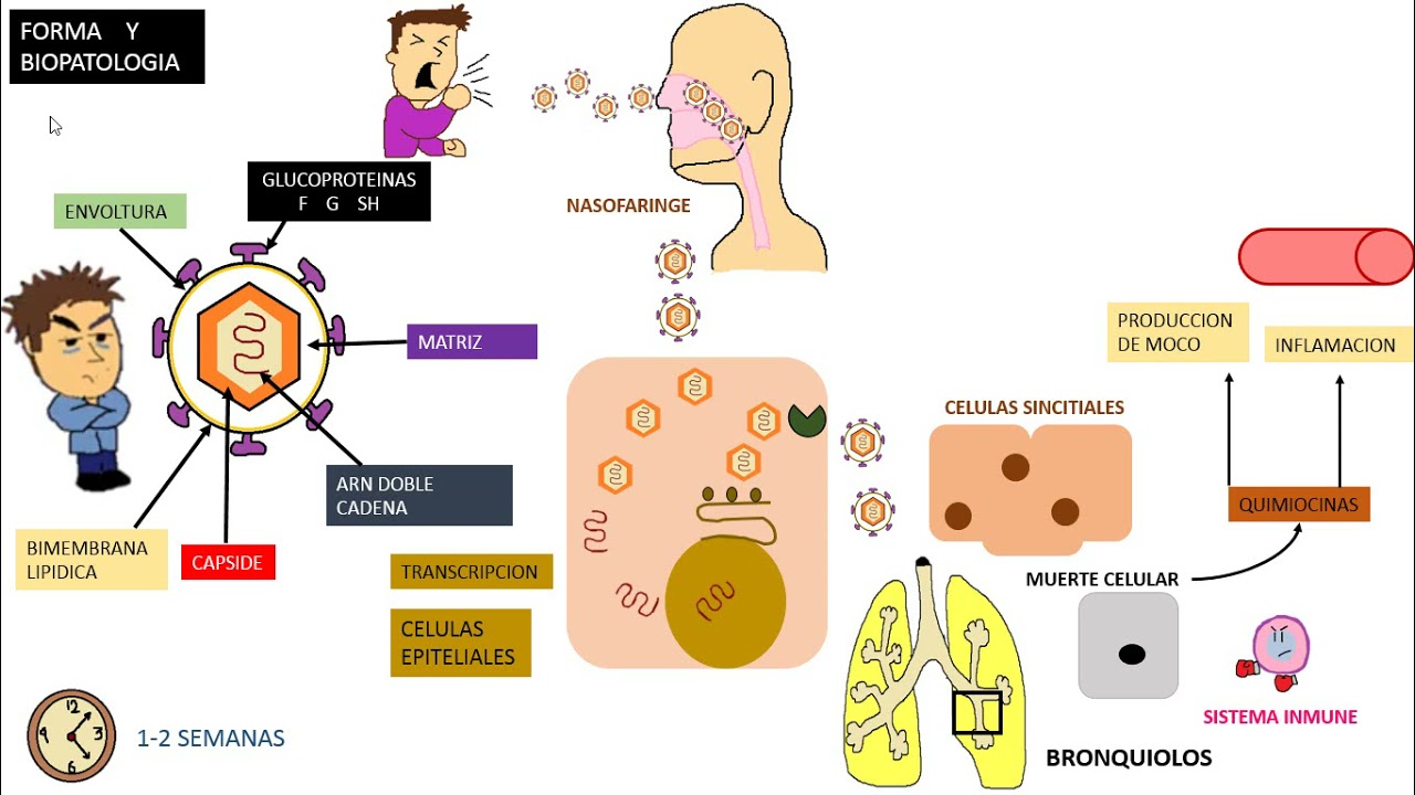 Virus Sincitial Respiratorio VSR