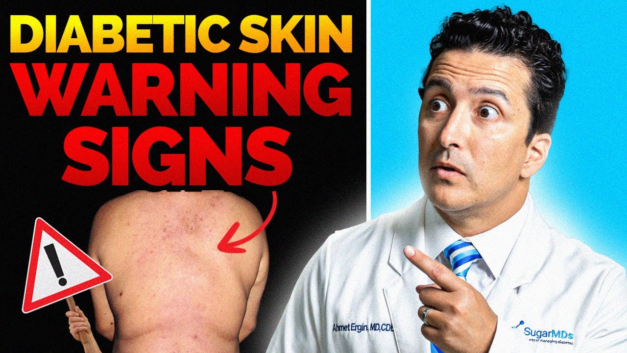 Diabetic Skin Signs You Should NEVER Ignore