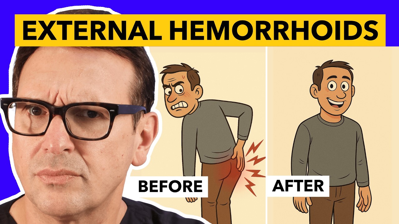 How To Get Rid Of External Hemorrhoids