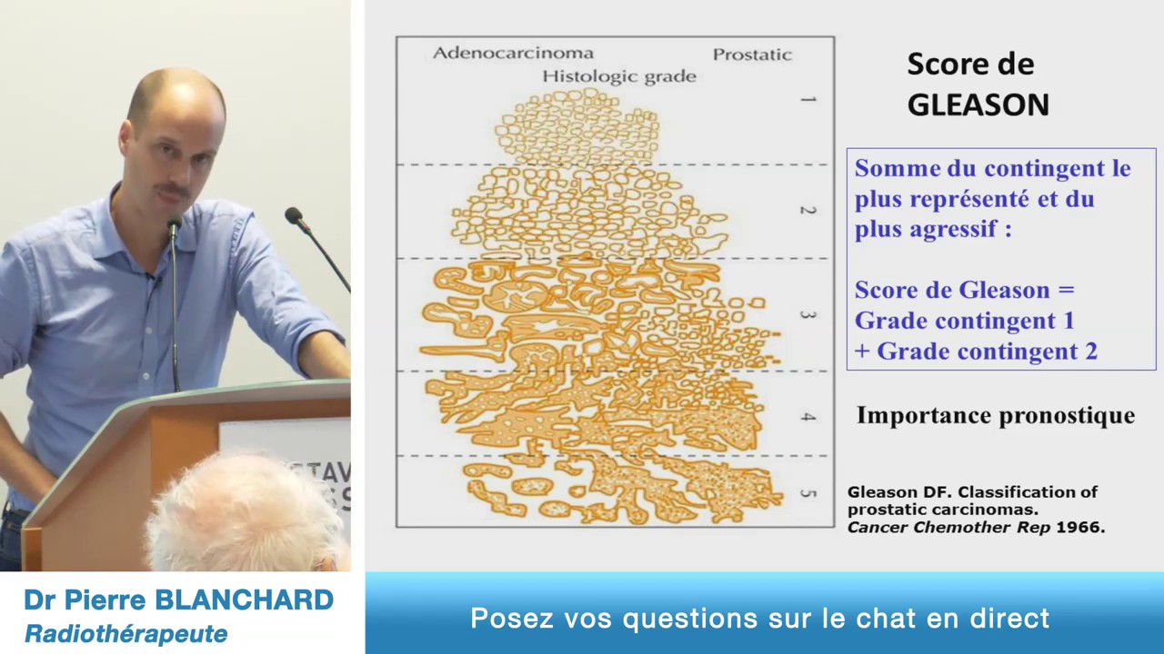 Cancer de la prostate localisé, les traitements et leurs effets secondaires