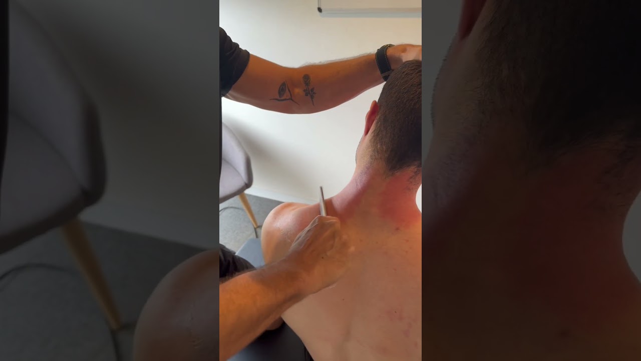Scraping for Shoulder Pain #graston #rotatorcuff #bursitis
