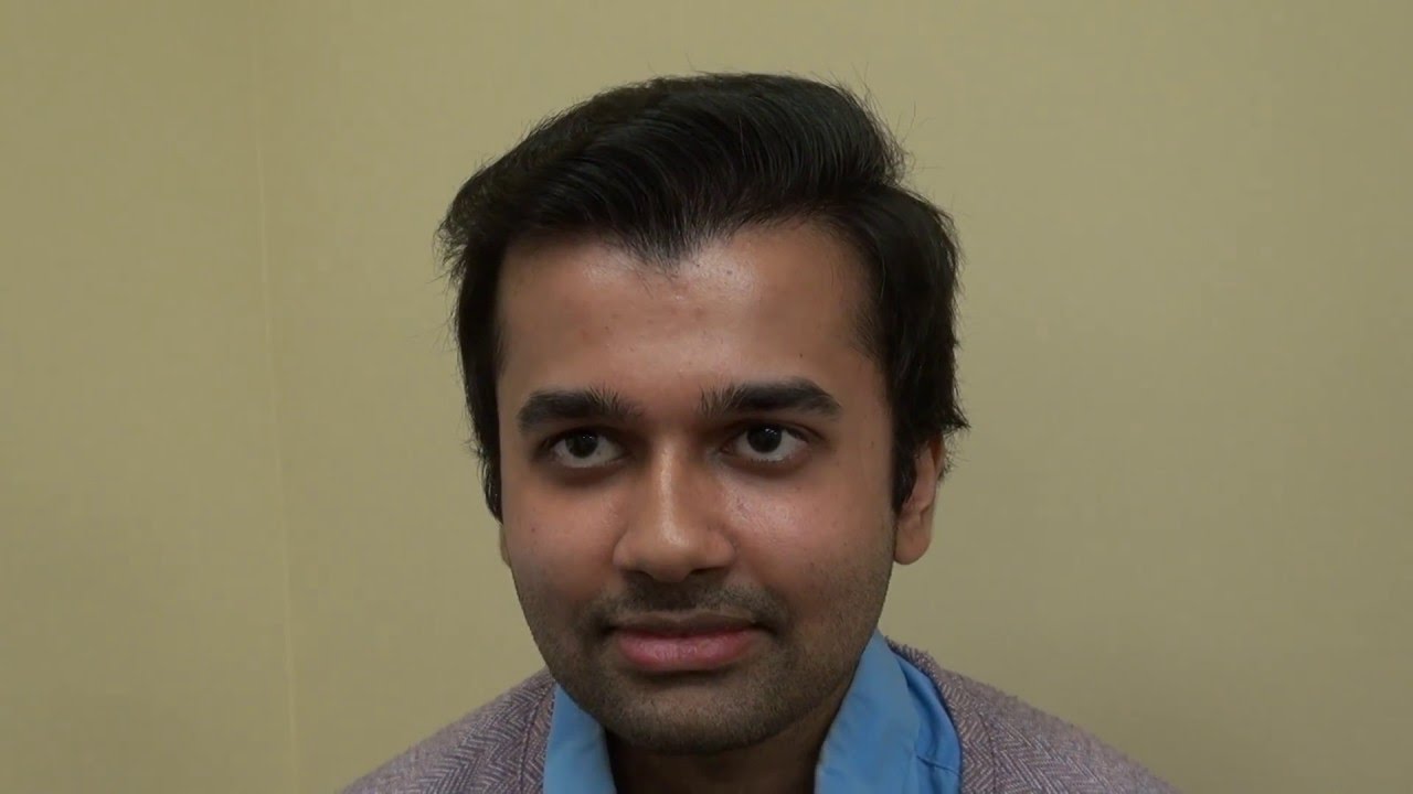 Bay Area Hair Transplant Surgery FUE Result Patient Experience Dr. Diep www.mhtaclinic.com