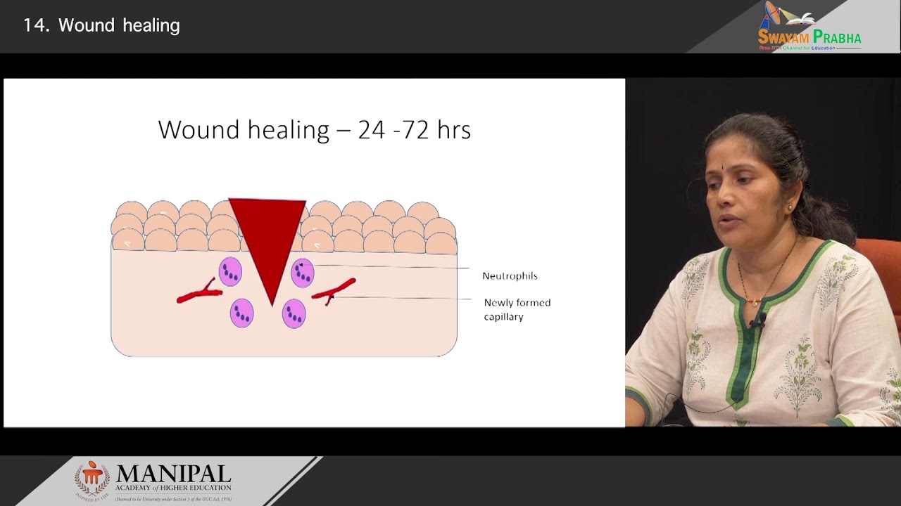 Wound healing- Primary & Secondary