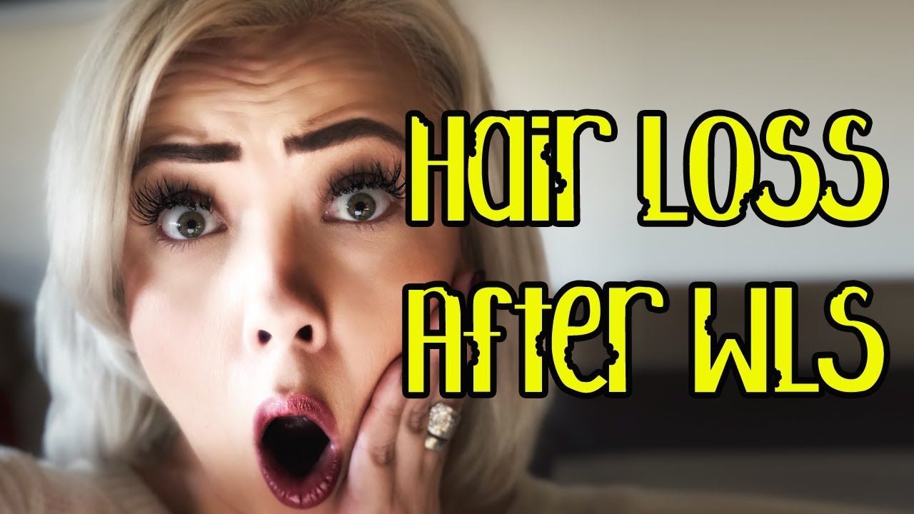 The TRUTH about HAIRLOSS after Weight Loss Surgery!