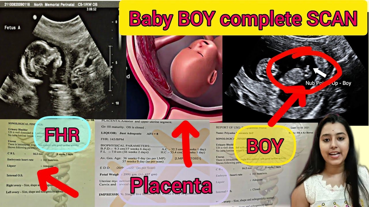 My complete PREGNANCY scan ||Baby boy scan || Baby boy symptoms || #anomalyscan