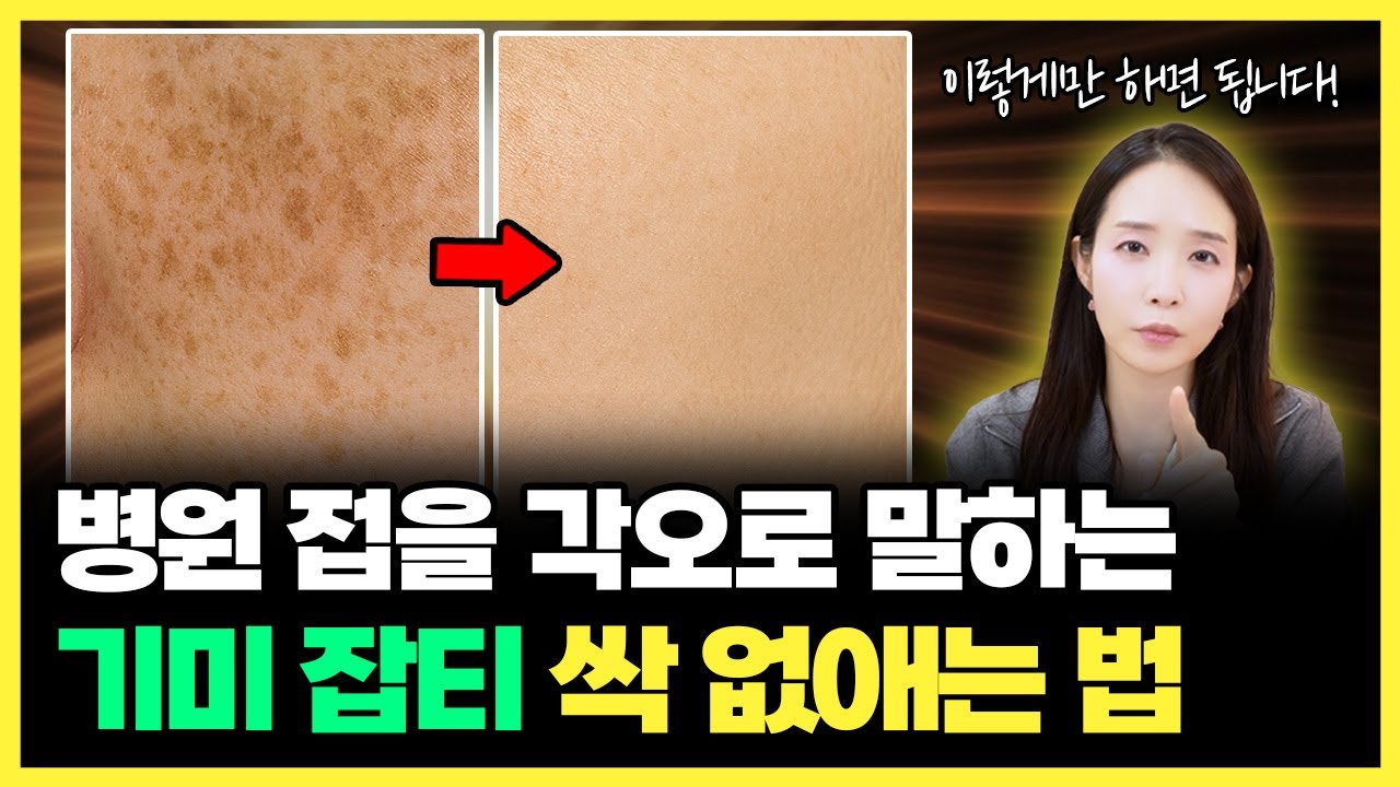 단돈 만원으로 기미, 잡티 집에서 손쉽게 없애는 방법! | 기미, 잡티 없애는 방법