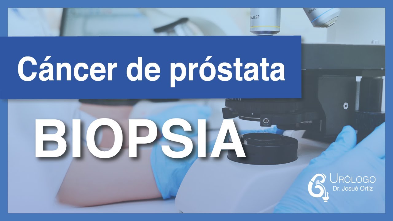 Cáncer de próstata - BIOPSIA│URÓLOGO Josué Ortiz