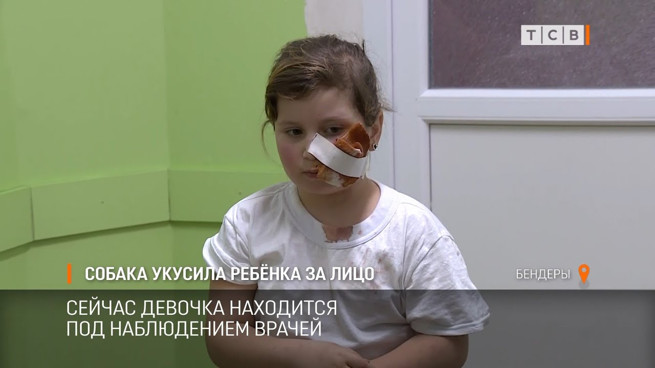 Собака укусила за лицо ребенка
