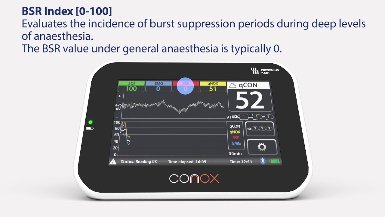 CONOX Smart Anesthesia